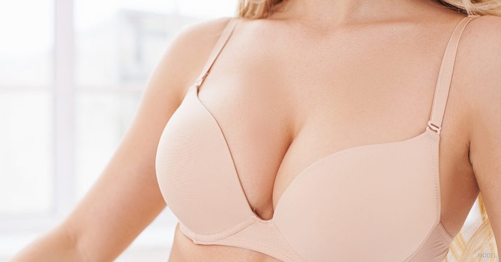 Breast Lift Scars: 7 Healing Process FAQs